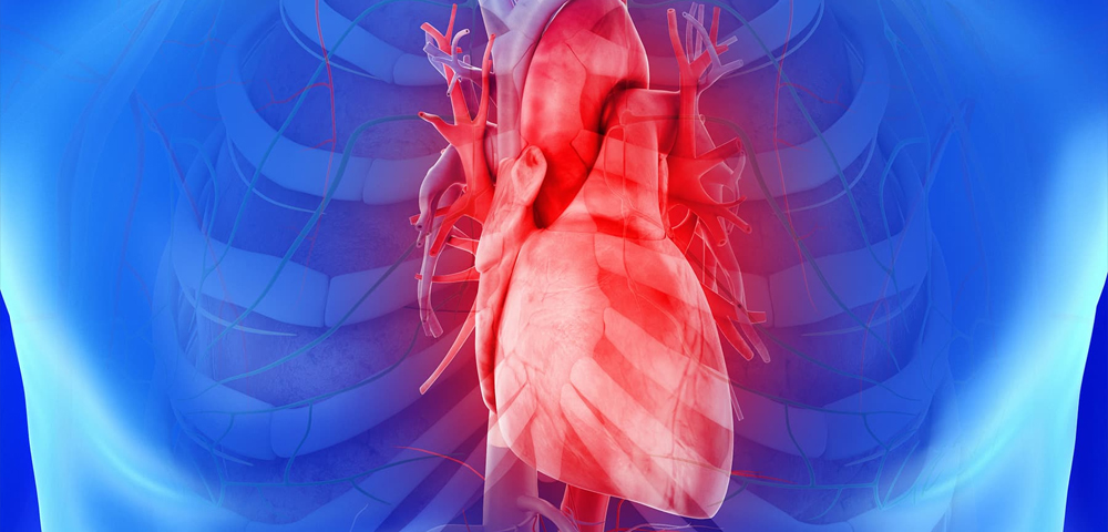 Cardiomyopathy treatment in Pune